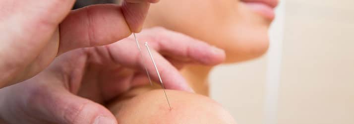 Acupuncture Gowrie IA Acupuncture